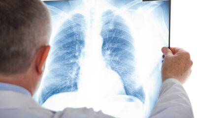 Medico esamina radiografia polmonare