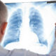 Medico esamina radiografia polmonare