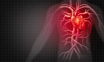Sistema cardiocircolatorio