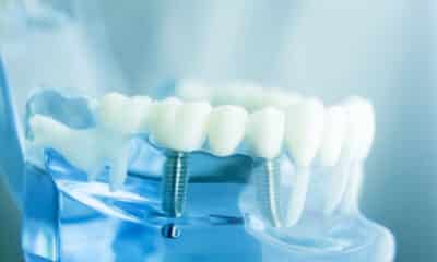 Modello di odontoiatria dentale