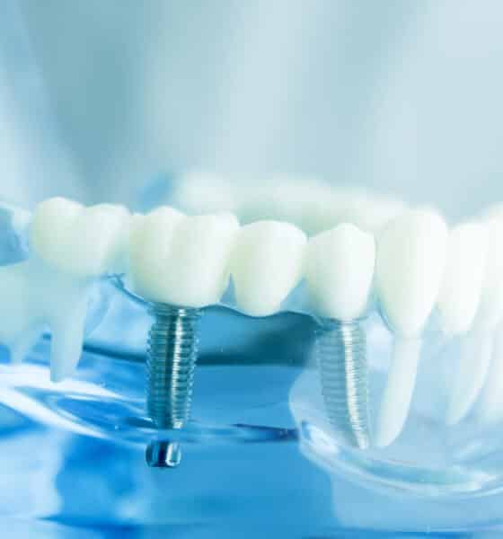 Modello di odontoiatria dentale