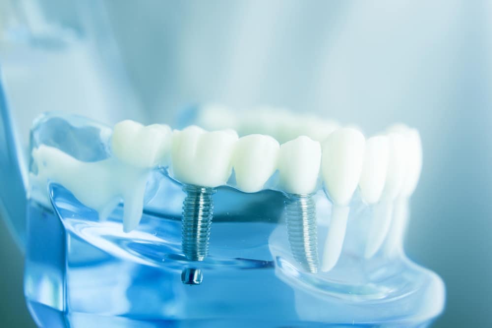 Modello di odontoiatria dentale