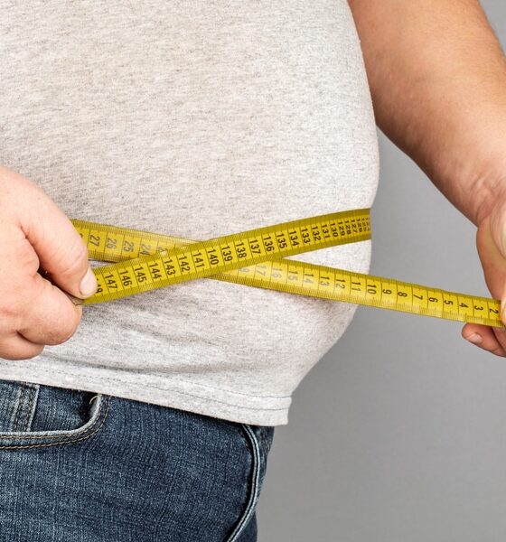 Uomo obeso - Diabete a Trieste