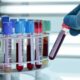 Campioni per analisi del sangue