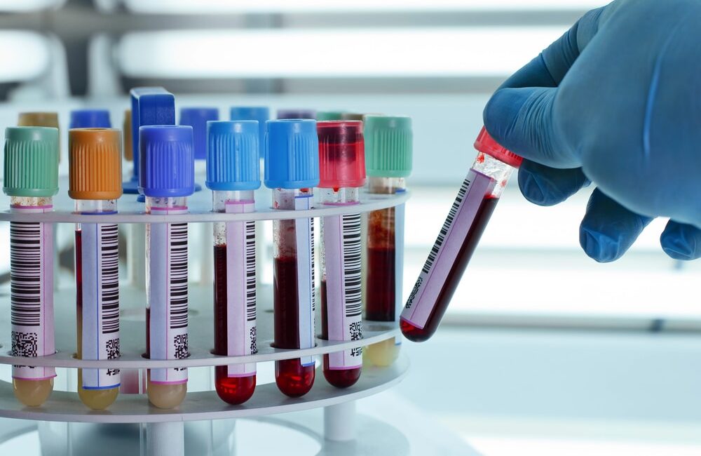 Campioni per analisi del sangue